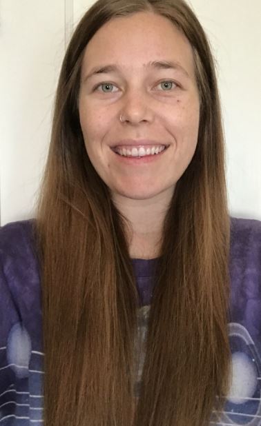 Stacey M. - Before